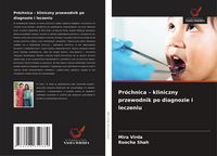 Produktbild: Pr&oacute;chnica - kliniczny przewodnik po diagnozie i leczeniu