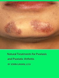 Produktbild: Natural Treatments for Psoriasis and Psoriatic Arthritis