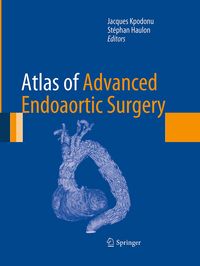 Produktbild: Atlas of Advanced Endoaortic Surgery