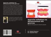 Produktbild: Approche esth&eacute;tique du d&eacute;chaussement des gencives