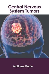 Produktbild: Central Nervous System Tumors