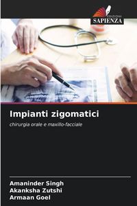 Produktbild: Impianti zigomatici