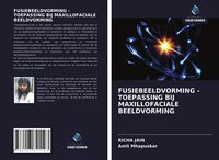Produktbild: Fusiebeeldvorming - Toepassing Bij Maxillofaciale Beeldvorming