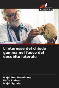 Produktbild: L'interesse del chiodo gamma nel fuoco del decubito laterale