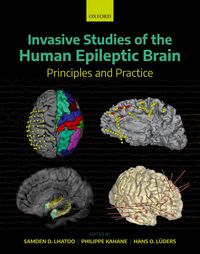 Produktbild: Invasive Studies of the Human Epileptic Brain