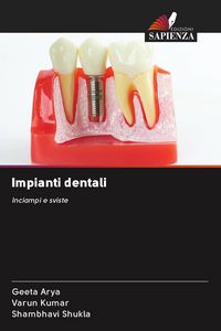 Produktbild: Impianti dentali