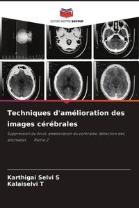 Produktbild: Techniques d'am&eacute;lioration des images c&eacute;r&eacute;brales