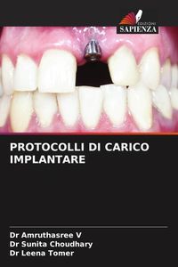 Produktbild: Protocolli Di Carico Implantare