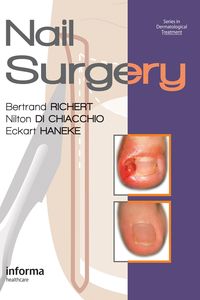 Produktbild: Nail Surgery
