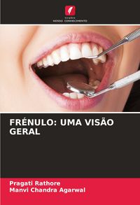 Produktbild: Fr&eacute;nulo: Uma Vis&atilde;o Geral