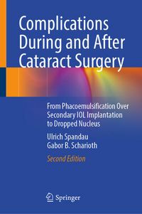 Produktbild: Complications During and After Cataract Surgery