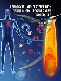 Produktbild: Leukocyte- and Platelet-Rich Fibrin in Oral Regenerative Procedures