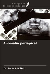 Produktbild: Anomal&iacute;a periapical