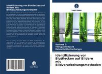 Produktbild: Identifizierung von Blutflecken auf Bildern mit Bildverarbeitungsmethoden