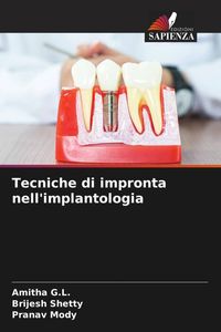 Produktbild: Tecniche di impronta nell'implantologia