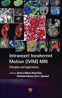 Produktbild: Intravoxel Incoherent Motion (IVIM) MRI