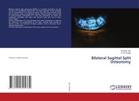 Produktbild: Bilateral Sagittal Split Osteotomy