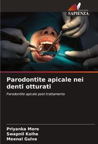 Produktbild: Parodontite apicale nei denti otturati