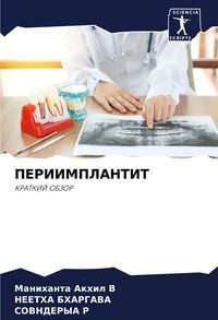 Produktbild: Periimplantit