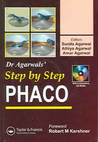 Produktbild: Step by Step Phaco with CDROM