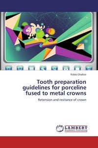 Produktbild: Tooth preparation guidelines for porceline fused to metal crowns