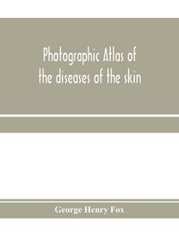 Produktbild: Photographic atlas of the diseases of the skin; A Series of Eighty Plates, Comprising more than One Hundred Illustrations, with Descriptive text, and