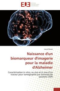 Produktbild: Naissance d'un biomarqueur d'imagerie pour la maladie d'Alzheimer