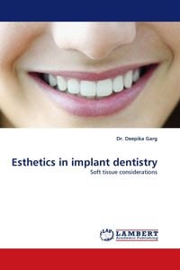 Produktbild: Esthetics in implant dentistry