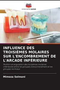 Produktbild: INFLUENCE DES TROISI&Egrave;MES MOLAIRES SUR L'ENCOMBREMENT DE L'ARCADE INF&Eacute;RIEURE