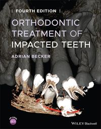 Produktbild: Orthodontic Treatment of Impacted Teeth