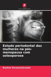 Produktbild: Estado periodontal das mulheres na p&oacute;s-menopausa com osteoporose