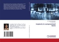 Produktbild: Implants in compromised bone