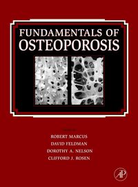 Produktbild: Fundamentals of Osteoporosis