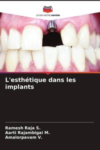Produktbild: L'esth&eacute;tique dans les implants