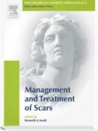 Produktbild: Management and Treatment of Scars