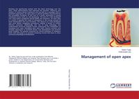 Produktbild: Management of open apex