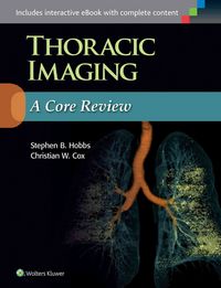 Produktbild: Hobbs, S: Thoracic Imaging: A Core Review