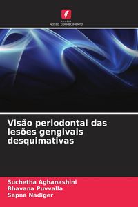 Produktbild: Vis&atilde;o periodontal das les&otilde;es gengivais desquimativas