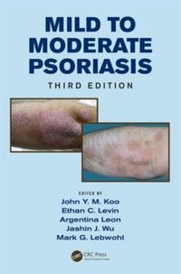 Produktbild: Mild to Moderate Psoriasis