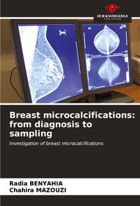 Produktbild: Breast microcalcifications: from diagnosis to sampling
