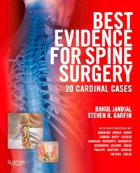 Produktbild: Best Evidence for Spine Surgery E-Book