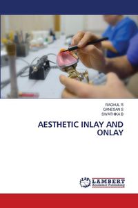 Produktbild: Aesthetic Inlay and Onlay