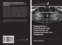 Produktbild: Diagn&oacute;stico y planificaci&oacute;n del tratamiento en restauraciones con implantes