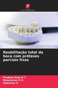 Produktbild: Reabilita&ccedil;&atilde;o total da boca com pr&oacute;teses parciais fixas