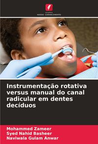 Produktbild: Instrumenta&ccedil;&atilde;o rotativa versus manual do canal radicular em dentes dec&iacute;duos