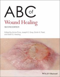 Produktbild: ABC of Wound Healing