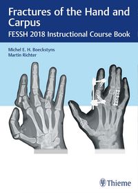 Produktbild: Fractures of the Hand and Carpus