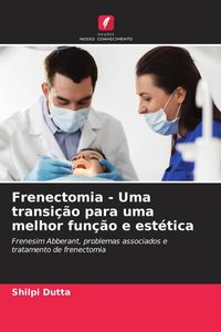 Produktbild: Frenectomia - Uma transi&ccedil;&atilde;o para uma melhor fun&ccedil;&atilde;o e est&eacute;tica
