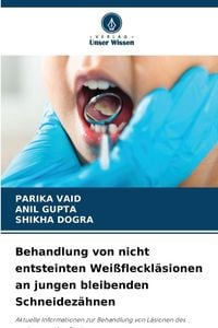 Produktbild: Behandlung von nicht entsteinten Wei&szlig;fleckl&auml;sionen an jungen bleibenden Schneidez&auml;hnen