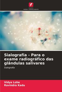 Produktbild: Sialografia - Para o exame radiogr&aacute;fico das gl&acirc;ndulas salivares